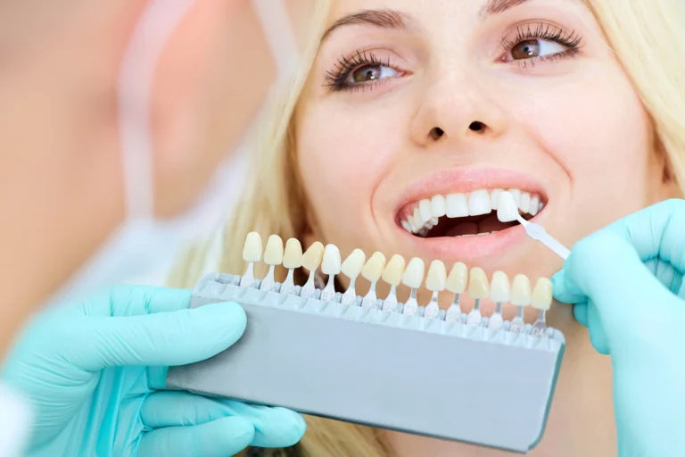 How Does Teeth Whitening Work with Dental Implants?
